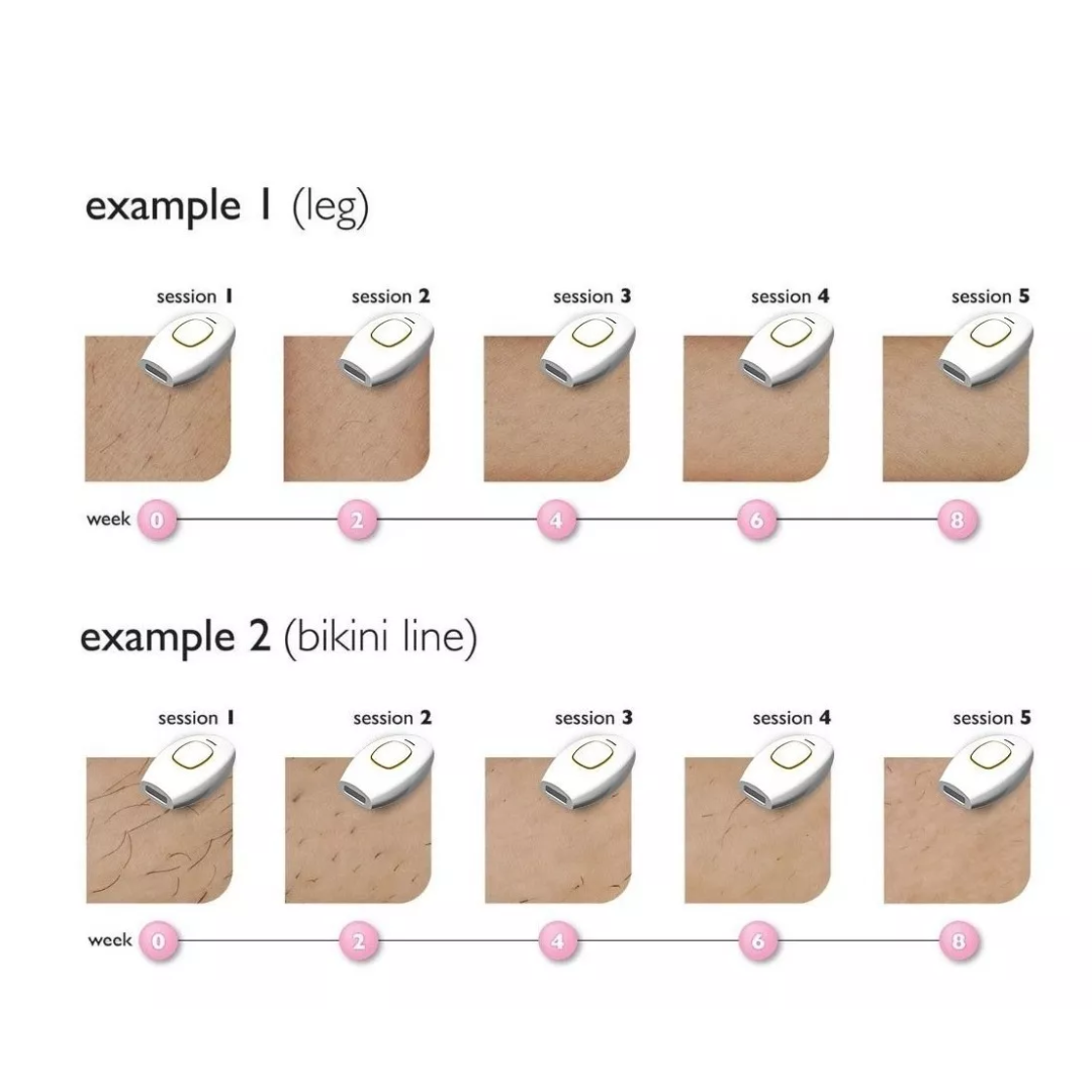 Depilador Láser Ipl Permanente