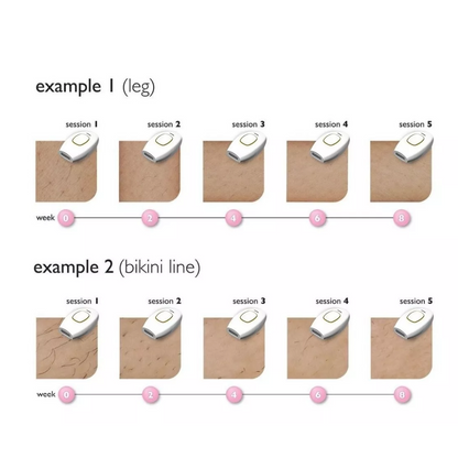 Depilador Láser Ipl Permanente