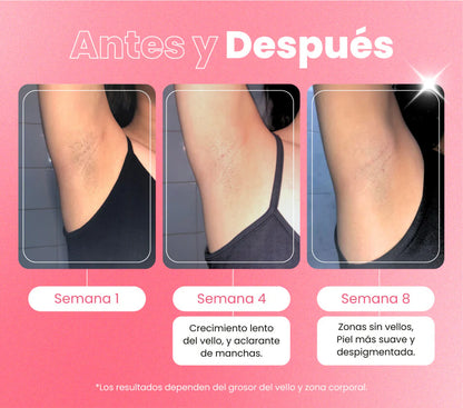 Kit Profesional de Depilación 4 en 1 + Facial Portátil GRATIS